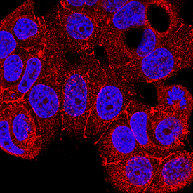Nectin-2/CD112 antibody in MCF-7 Human Cell Line by Immunocytochemistry (ICC).