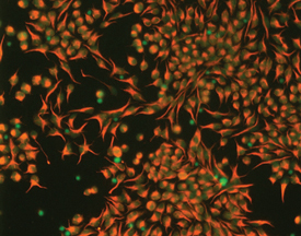 Nestin antibody in Rat Cortical Stem Cells by Immunocytochemistry (ICC).