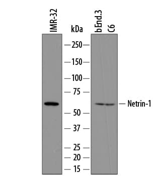 Detection of Human, Mouse, and Rat Netrin-1 antibody by Western Blot.
