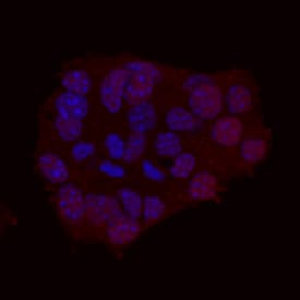 NeuroD1 antibody in  beta TC-6 Mouse Cell Line by Immunocytochemistry (ICC).