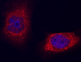 Niemann-Pick Type C2/NPC2 antibody in SK-Hep-1 Human Cell Line by Immunocytochemistry (ICC).