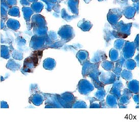 Noggin antibody in Embryonic Mouse Cardiac Tissue by Immunohistochemistry (IHC-Fr).