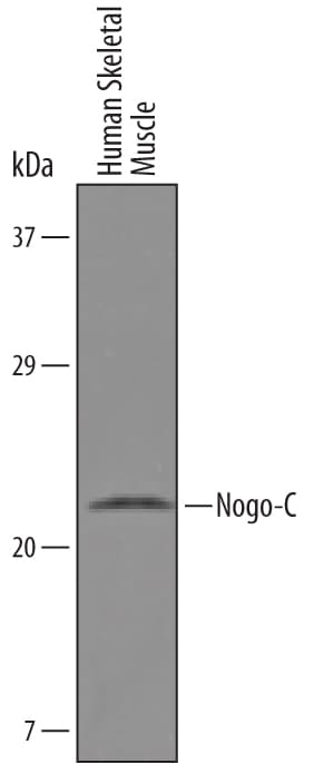 Detection of Human Nogo-C antibody by Western Blot.
