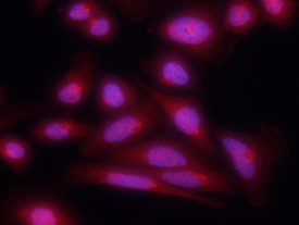 Notch‑1 antibody in Saos-2 Human Cell Line by Immunocytochemistry (ICC).