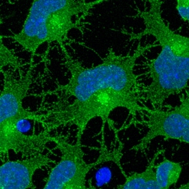 Notch-1 antibody in Rat Cortical Stem Cells by Immunocytochemistry (ICC).
