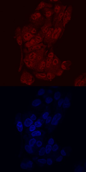 ONECUT2/OC-2 antibody in HepG2 Human Cell Line by Immunocytochemistry (ICC).