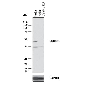 Western Blot Shows Human OSM R beta  Antibody Specificity by Using Knockout Cell Line.