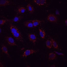 Occludin antibody in HUVEC Human Cells by Immunocytochemistry (ICC).