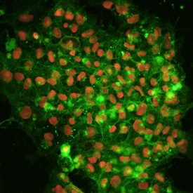 Alkaline Phosphatase and Oct‑3/4 antibody in BG01V Human Stem Cells by Immunocytochemistry (ICC).