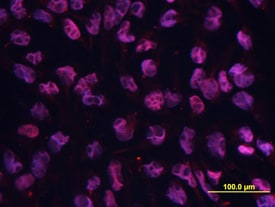 Oct-3/4 antibody in BG01V Human Embryonic Stem Cells by Immunocytochemistry (ICC).