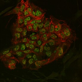 Oct-4A and E-Cadherin antibody in BG01V Human Stem Cells by Immunocytochemistry (ICC).