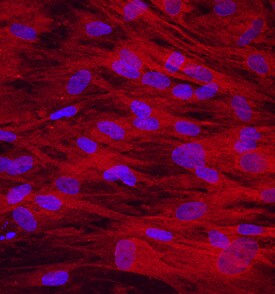 Osteoadherin/OSAD antibody in Human Mesenchymal Stem Cells by Immunocytochemistry (ICC).