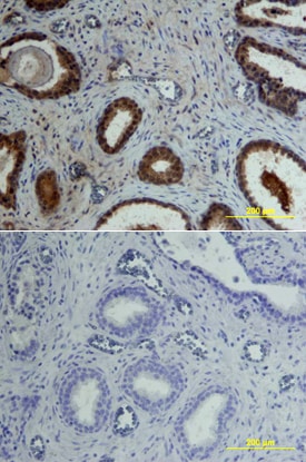 Osteoprotegerin/TNFRSF11B antibody in Human Prostate by Immunohistochemistry (IHC-P).