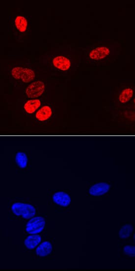 Osterix/Sp7 antibody in Saos-2 Human Cell Line by Immunocytochemistry (ICC).