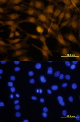 Otx2 antibody in NTera-2 Human Cell Line by Immunocytochemistry (ICC).