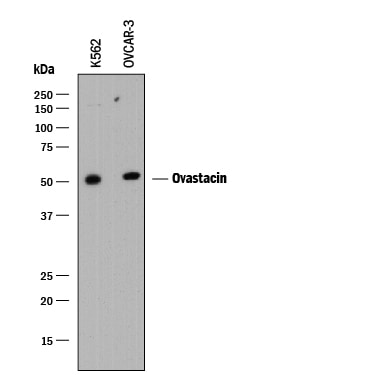 Detection of Human Ovastacin antibody by Western Blot.