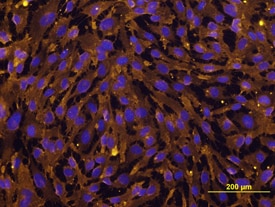 E-Selectin (CD62E)/P-Selectin (CD62P) antibody in HUVEC Human Cells by Immunocytochemistry (ICC).