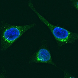 Protein Disulfide Isomerase/P4HB antibody in HeLa Human Cell Line by Immunocytochemistry (ICC).