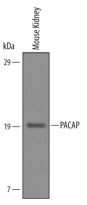Detection of Mouse PACAP/ADCYAP1 antibody by Western Blot.