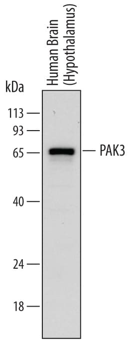 Detection of Human PAK3 antibody by Western Blot.