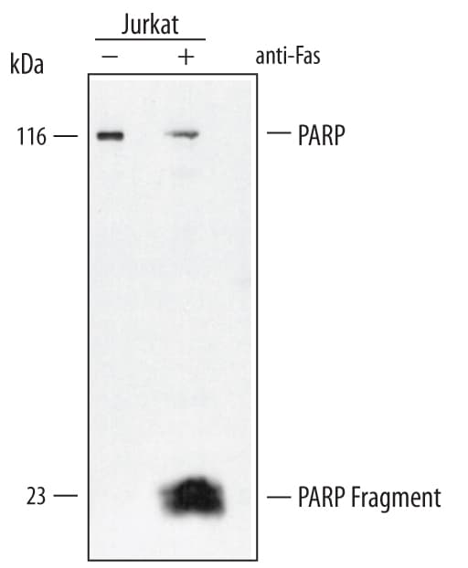 Detection of Human PARP antibody by Western Blot.