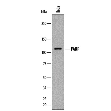 Detection of Human PARP antibody by Western Blot.
