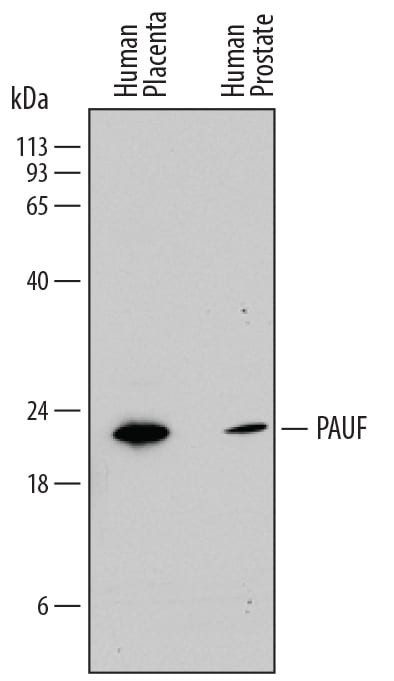 Detection of Human PAUF/ZG16B antibody by Western Blot.