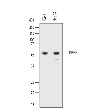 Detection of Human PBEF/Visfatin antibody by Western Blot.