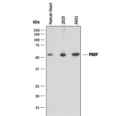 Detection of Human PBEF/Visfatin antibody by Western Blot.