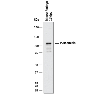 Detection of P-Cadherin antibody by Western Blot.
