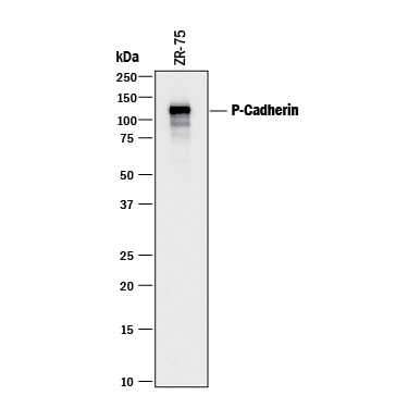 Detection of Human P-Cadherin antibody by Western Blot.
