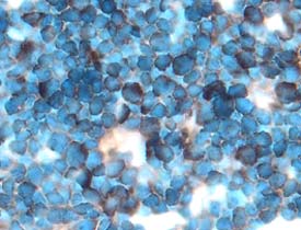 PD‑L2 antibody in Mouse Thymus by Immunohistochemistry (IHC-Fr).