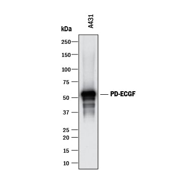 Detection of Human PD-ECGF/Thymidine Phosphorylase antibody by Western Blot.