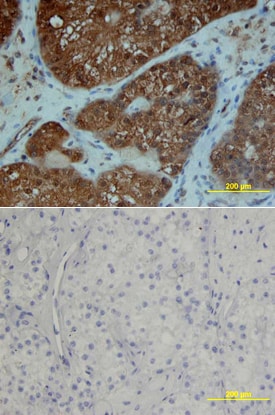 PDGF Ra antibody in Human Ovary by Immunohistochemistry (IHC-P).