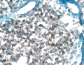 PDGF Ra antibody in Mouse Embryo by Immunohistochemistry (IHC-Fr).