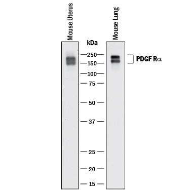 Detection of Mouse PDGF Ra antibody by Western Blot.