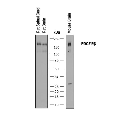 Detection of Rat and Mouse PDGF R beta  antibody by Western Blot.