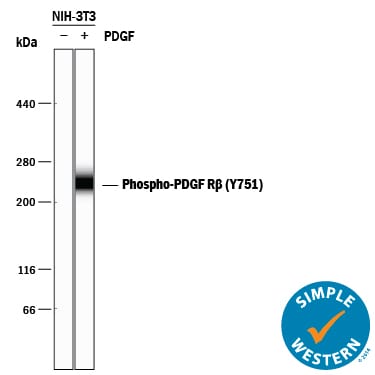 Detection of Mouse Phospho-PDGF R beta  (Y751) antibody by Simple WesternTM.