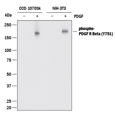 Detection of Human and Mouse Phospho-PDGF R beta  (Y751) antibody by Western Blot.