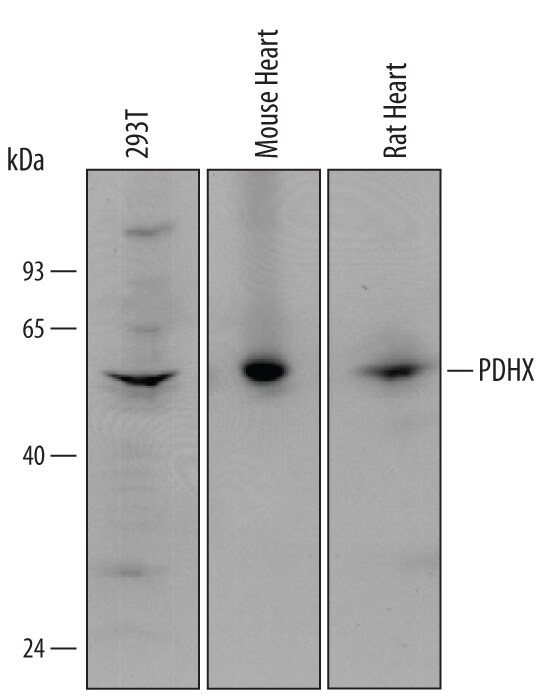 Detection of Human, Mouse, and Rat PDHX antibody by Western Blot.