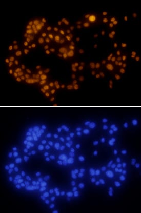 PDX-1/IPF1 antibody in  beta TC-6 Mouse Cell Line by Immunocytochemistry (ICC).