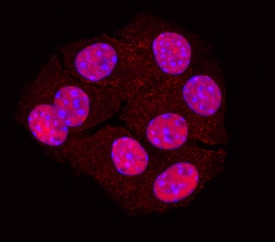 PDX-1/IPF1 antibody in  beta TC-6 Mouse Cell Line by Immunocytochemistry (ICC).