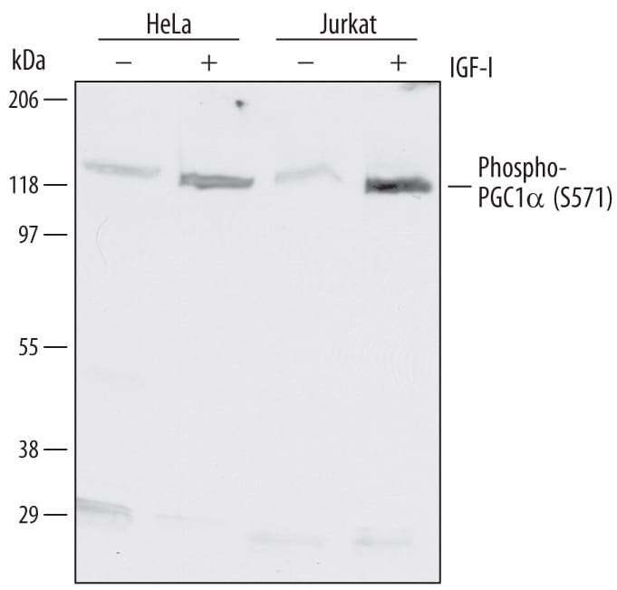 Detection of Human Phospho-PGC1a (S571) antibody by Western Blot.