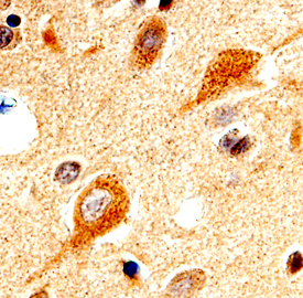 PINK1 antibody in Human Brain by Immunohistochemistry (IHC-P).