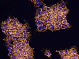 PIWIL4 antibody in BG01V Human Stem Cells by Immunocytochemistry (ICC).