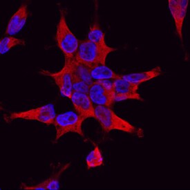 PI 3-Kinase C2 beta  antibody in HEK293 Human Cell Line by Immunocytochemistry (ICC).