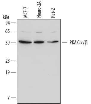 Detection of Human/Mouse/Rat PKA Ca/ beta  antibody by Western Blot.