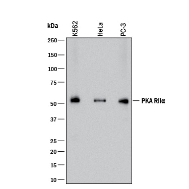 Detection of Human PKA RIIa antibody by Western Blot.