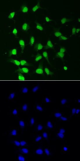 PKC beta 1 antibody in Rat Cortical Stem Cells by Immunocytochemistry (ICC).