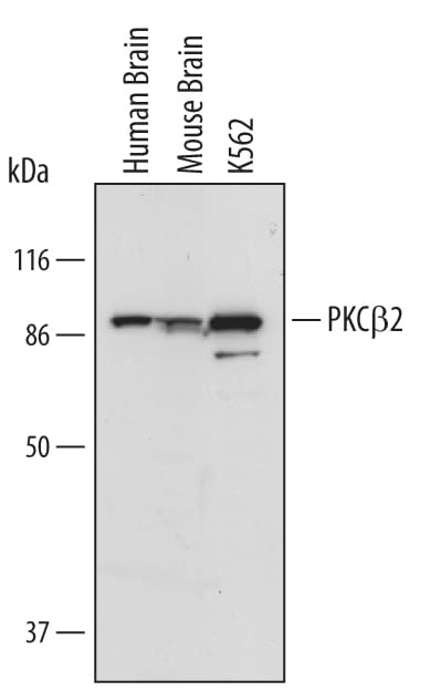 Detection of Human PKC beta 2 antibody by Western Blot.